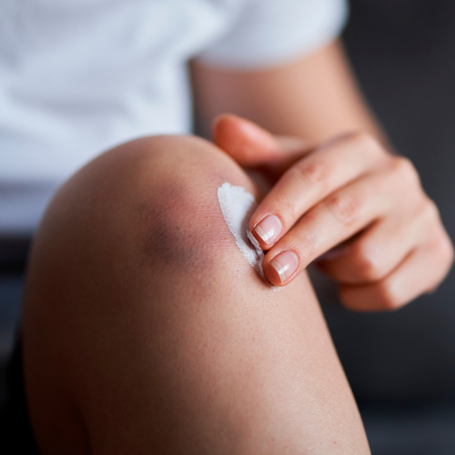 Creme Lenitive e Curative